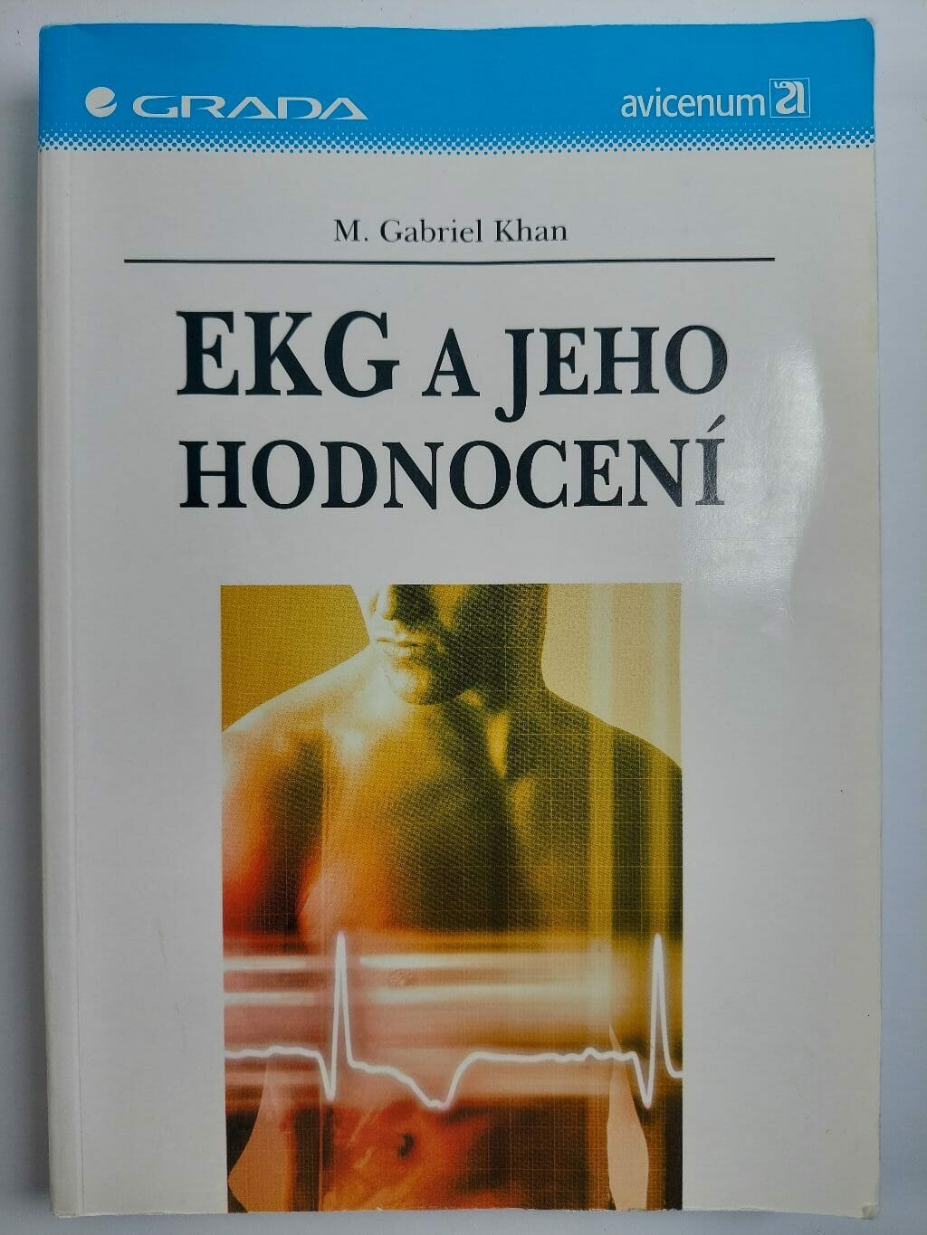 Levně EKG a jeho hodnocení