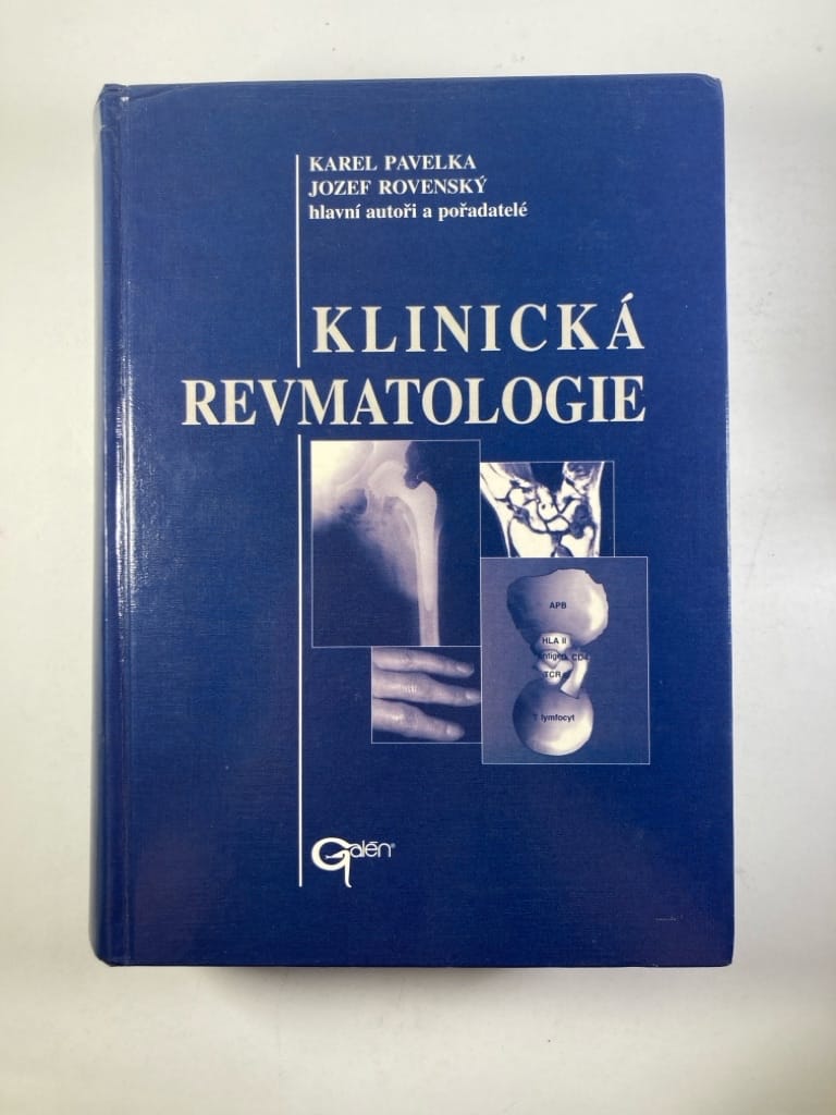 Levně Klinická revmatologie