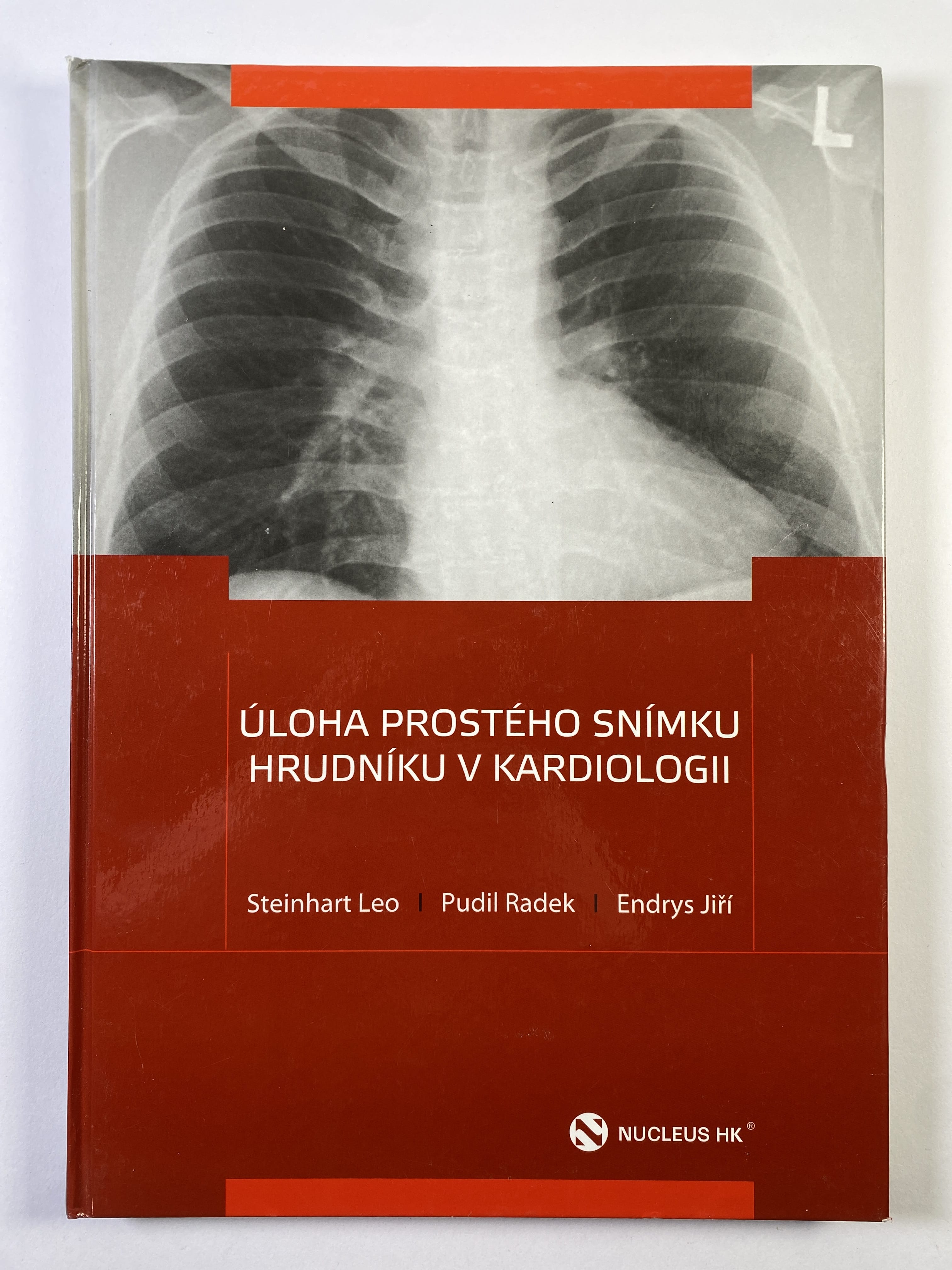 Levně Úloha prostého snímku hrudníku v kardiologii