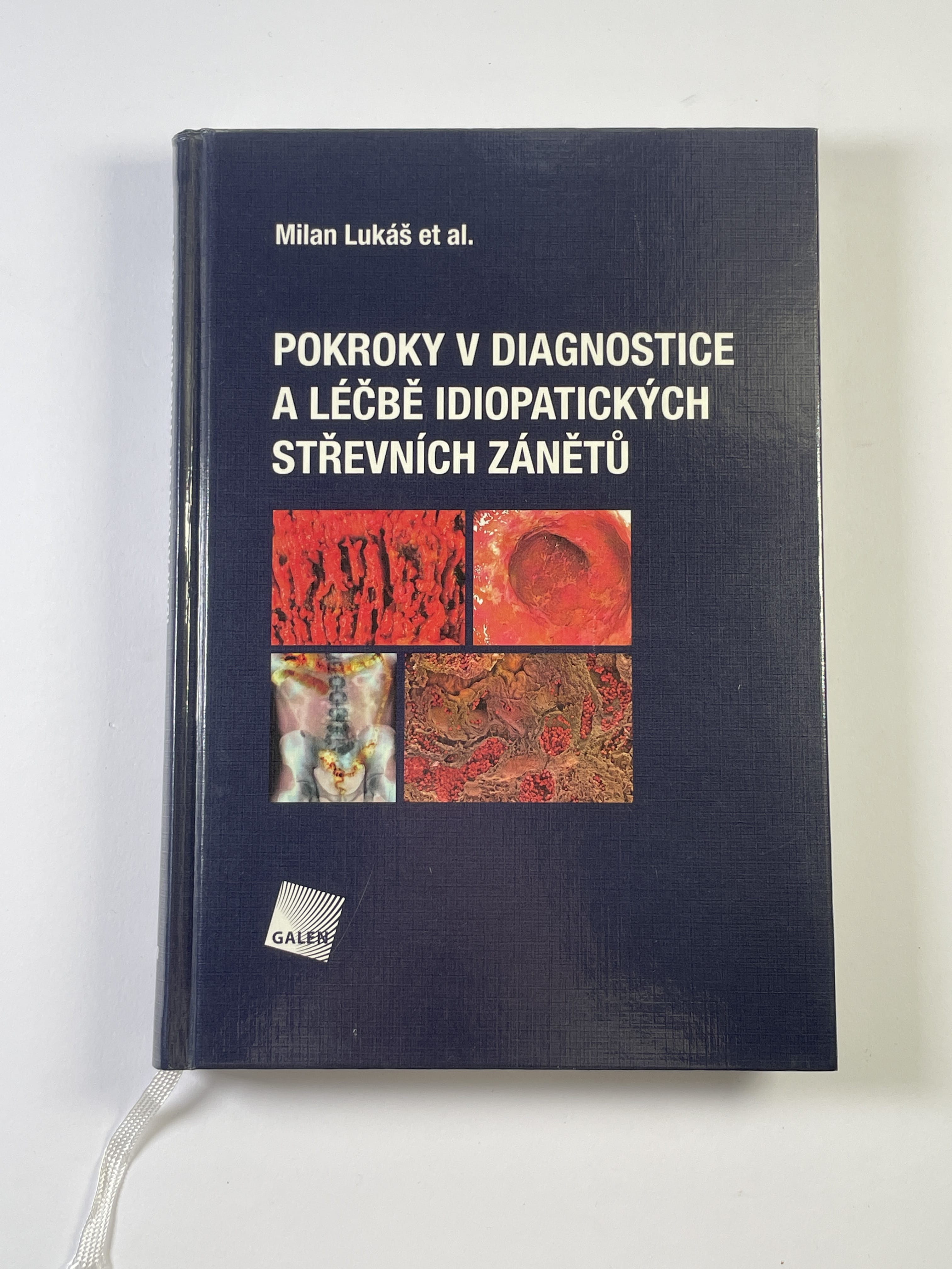 Levně Pokroky v diagnostice a léčbě idiopatických střevních zánětů