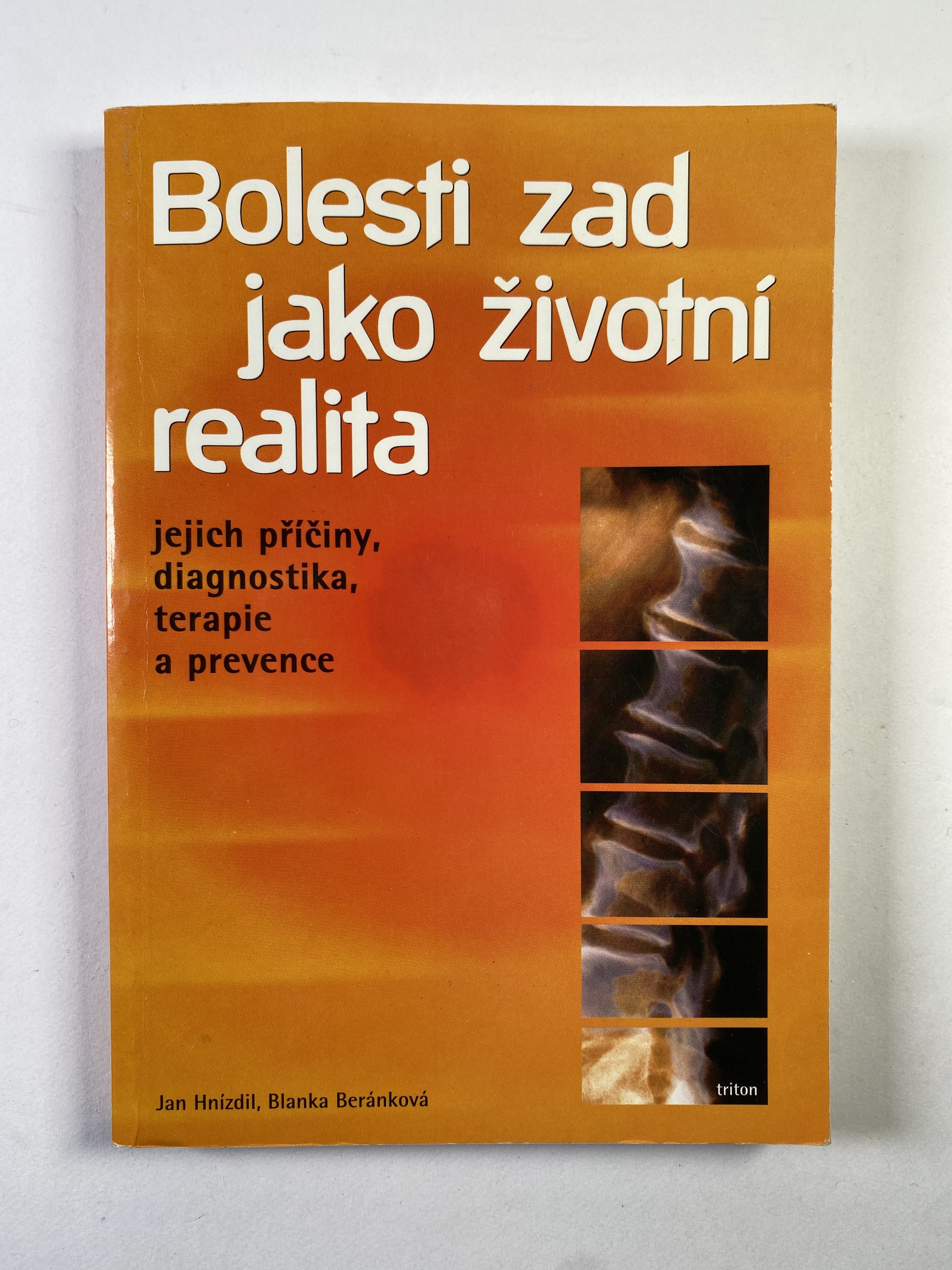 Bolesti zad jako životní realita: jejich příčiny, diagnostika, terapie a prevence